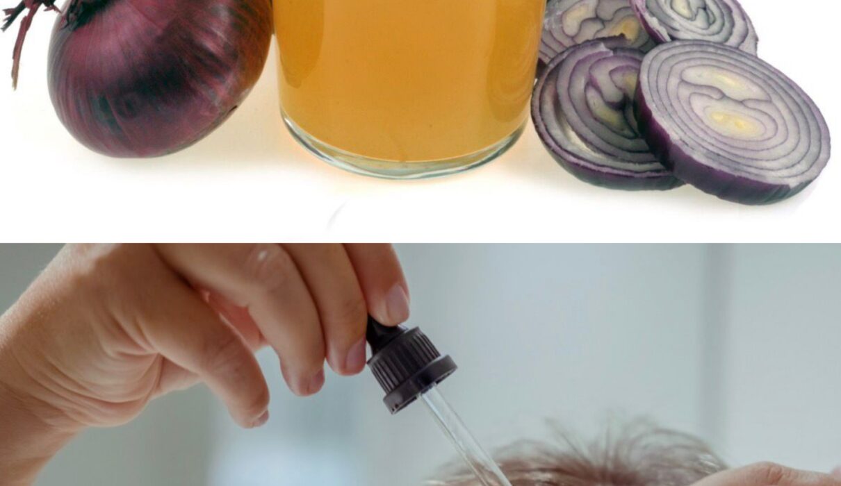 Person applying fresh onion juice to scalp as a natural remedy for hair growth during an 8-week hair care experiment