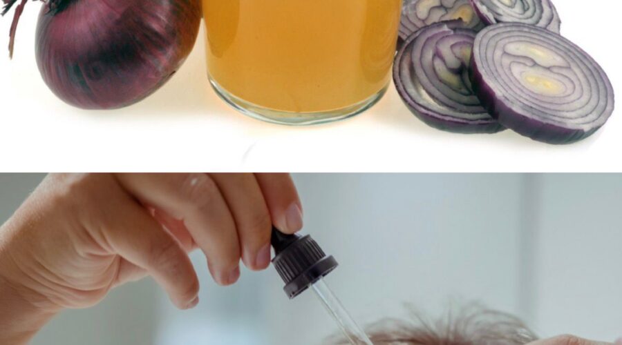 Person applying fresh onion juice to scalp as a natural remedy for hair growth during an 8-week hair care experiment